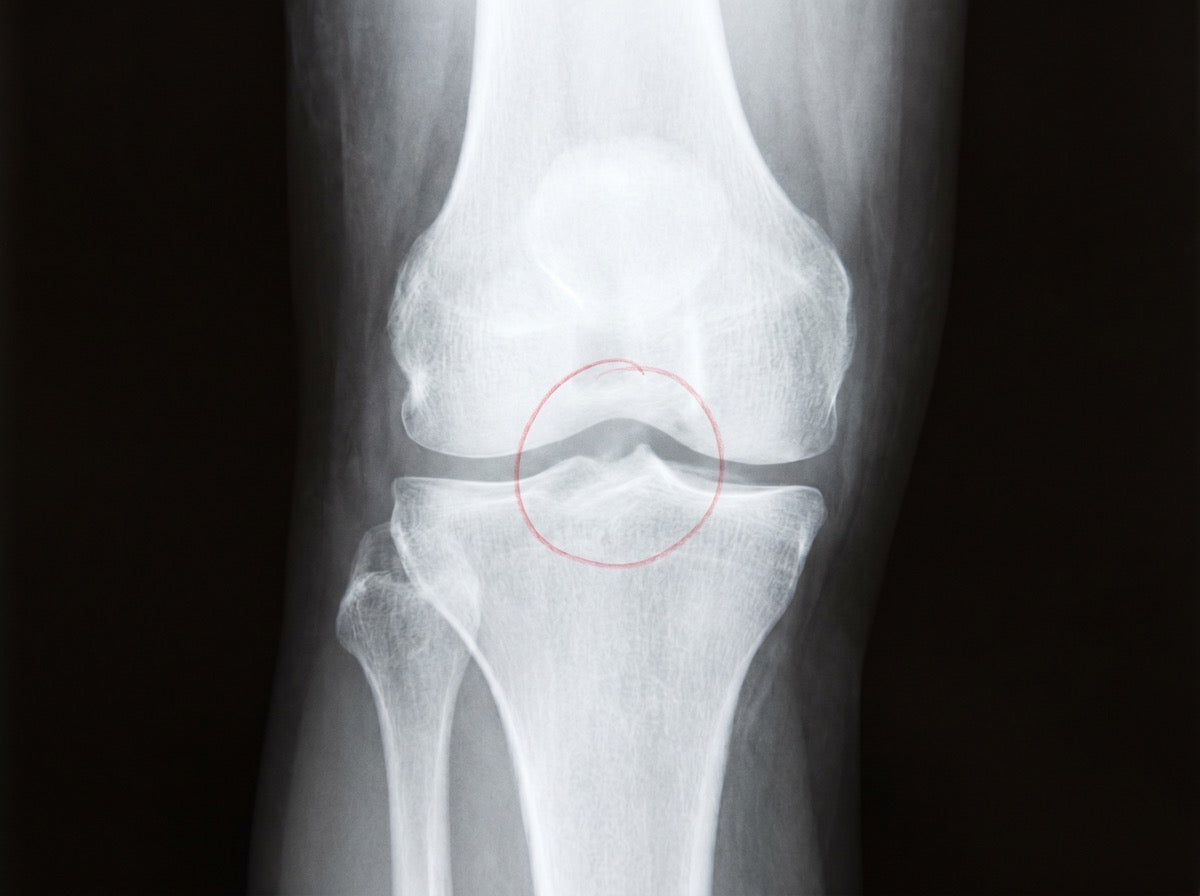 04-clean-xray