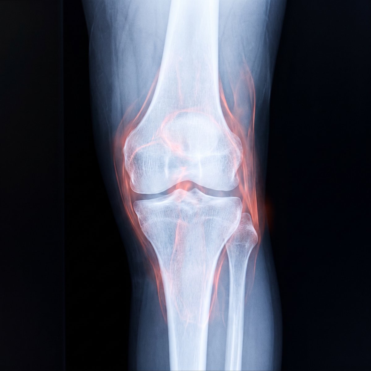 bc-mech-3-xray-tendons.jpg