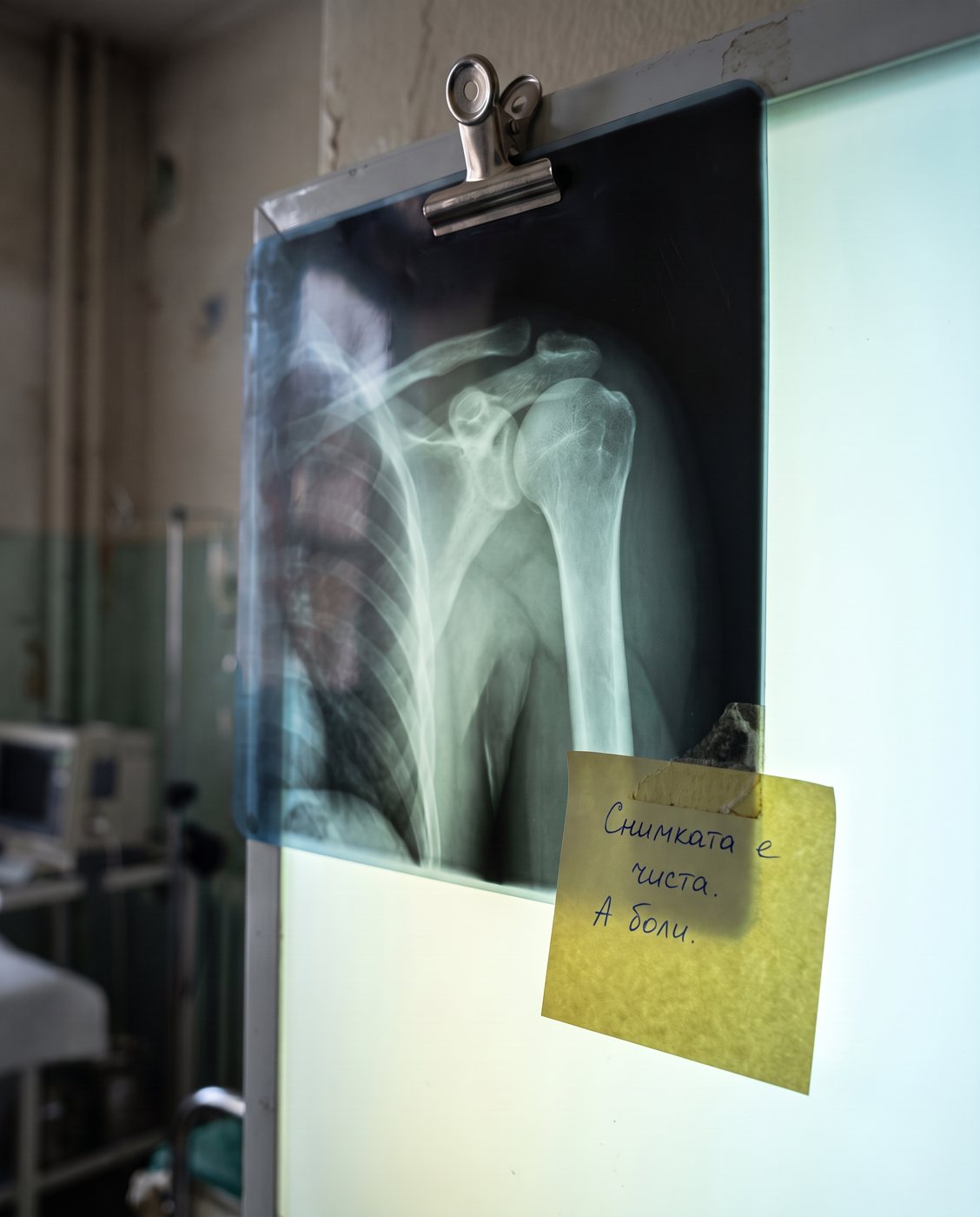 msk-s3-xray.jpg