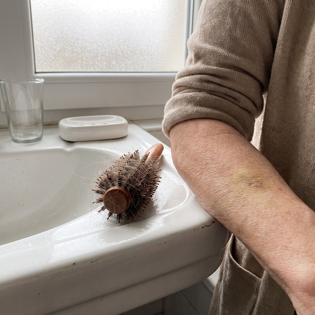vks-check-brush-bruise.jpg